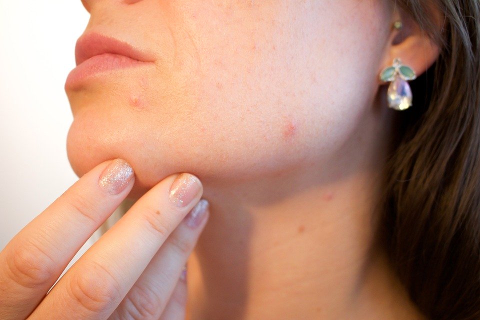 Jaké kožní nemoci nás nejčastěji trápí? Naučte se je rozpoznat